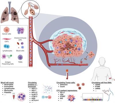 Soluble biomarkers to predict clinical outcomes in non-small cell lung cancer treated by immune checkpoints inhibitors